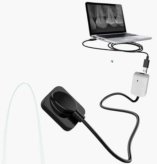 راهنمای خرید سنسور RVG دندانپزشکی