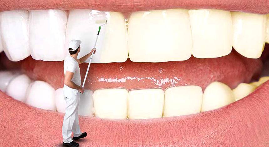 سفید کردن دندان با روش‌ های خانگی