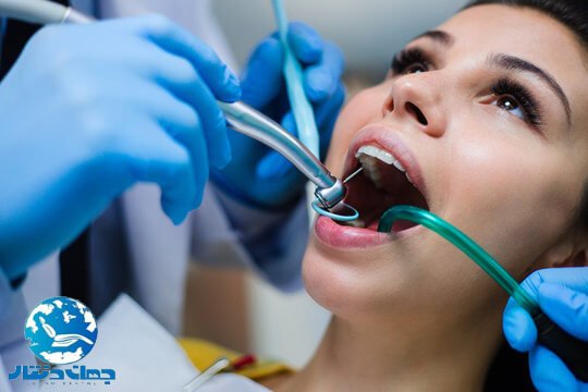 کاربرد روتاری دندانپزشکی