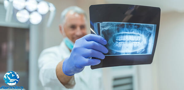 راهنمای خرید رادیوگرافی دندانپزشکی