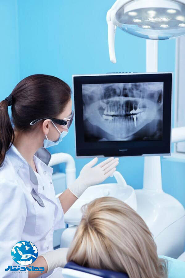 راهنمای خرید رادیوگرافی دندانپزشکی