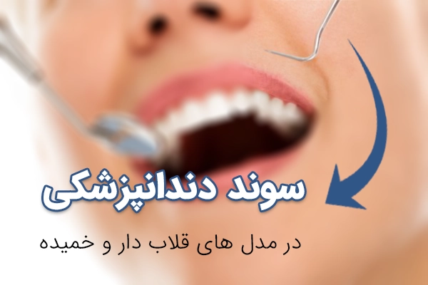 ابزار دندانپزشکی سوند