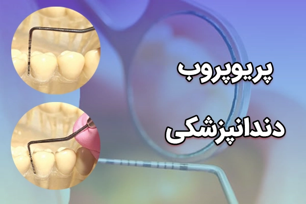 ابزار دندانپزشکی پریوپروب 